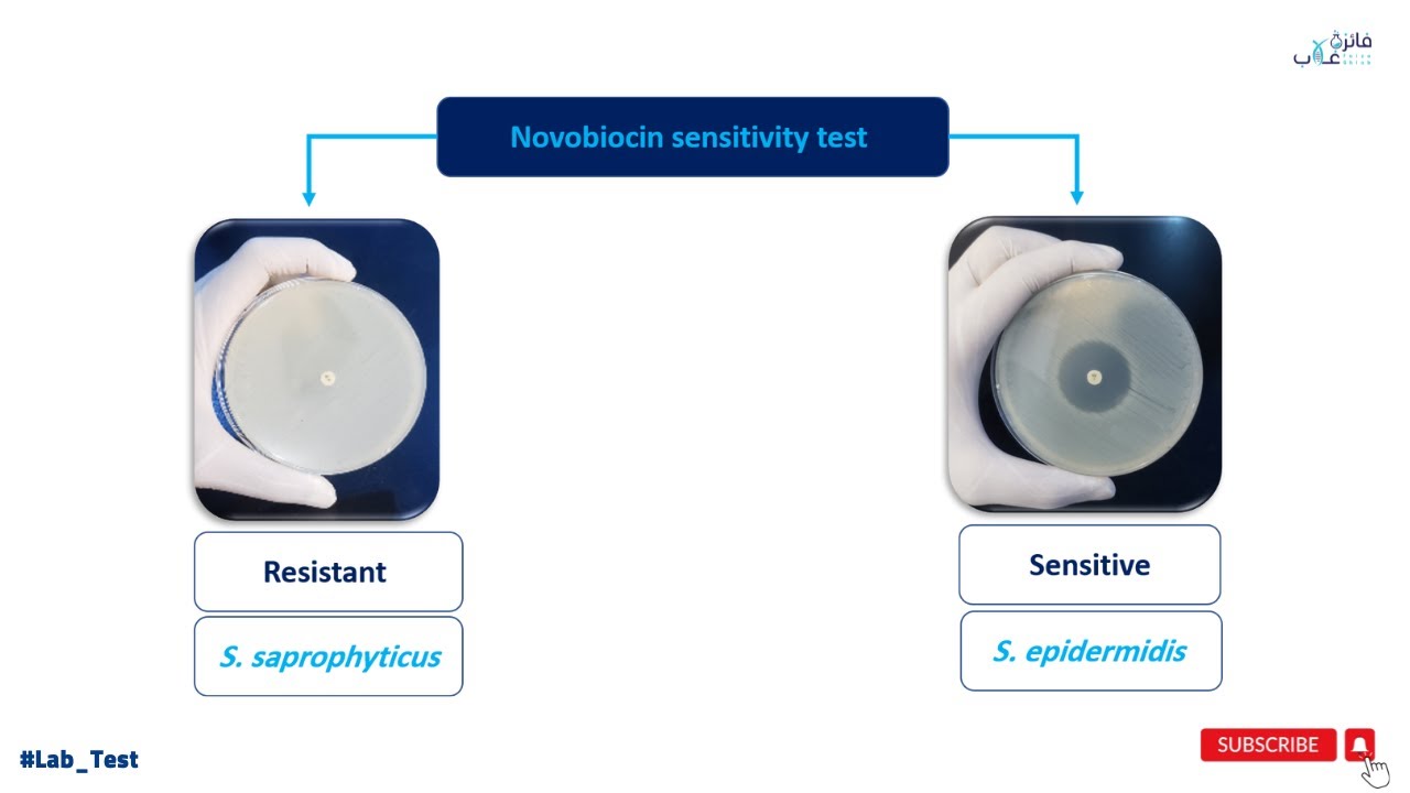 Novobiocin Sensitivity Test