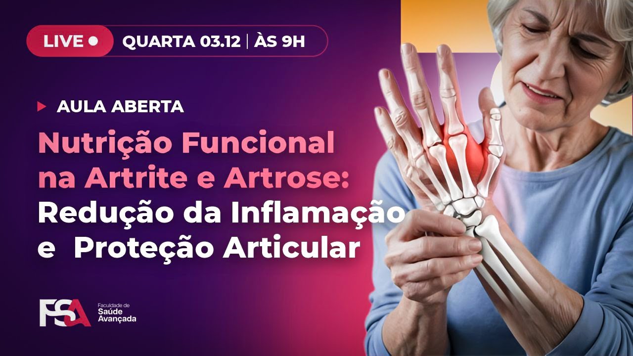 Nutrição Funcional na Artrite e Artrose: Redução da Inflamação e  Proteção Articular