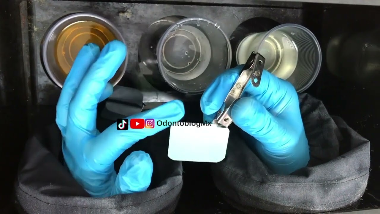 Revelado y Fijado manual de radiografías dentales  🩻 🦷 paso a paso