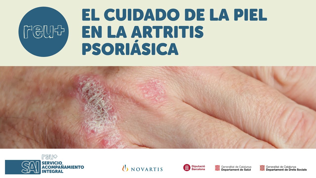 El cuidado de la piel en la Artritis Psoriásica