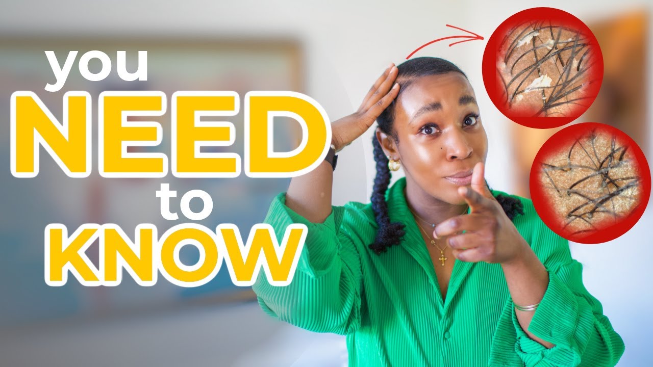 Is your scalp DRY, OILY, or NORMAL?! // Scalp Care Series