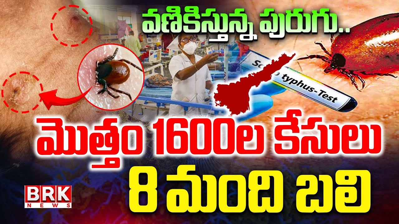 Scrub Typhus Tension in AP : వణికిస్తున్న పురుగు..| Guntur GGH | Scrub typhus || BRK News