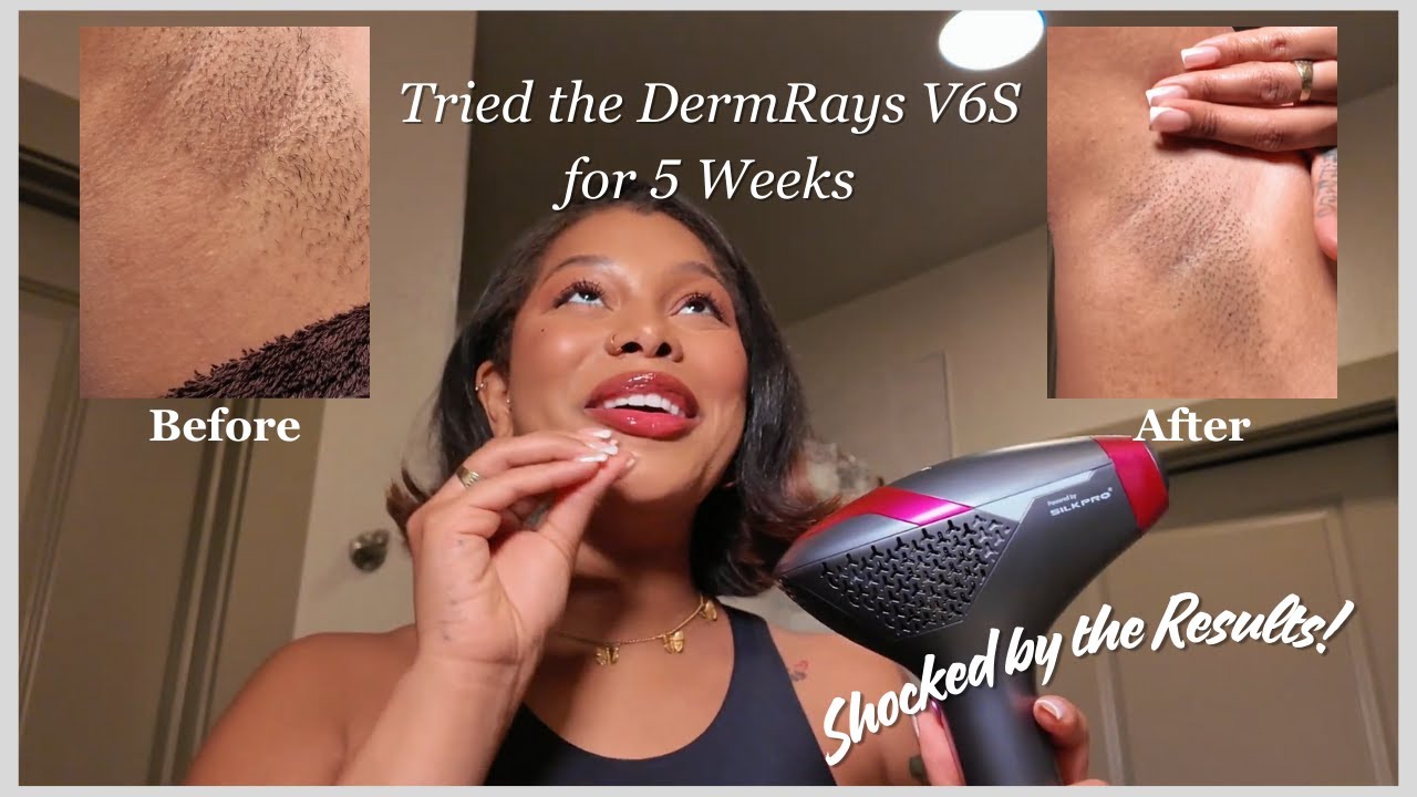 Tried the DermRays V6S for 5 Weeks — Shocked by the Results!