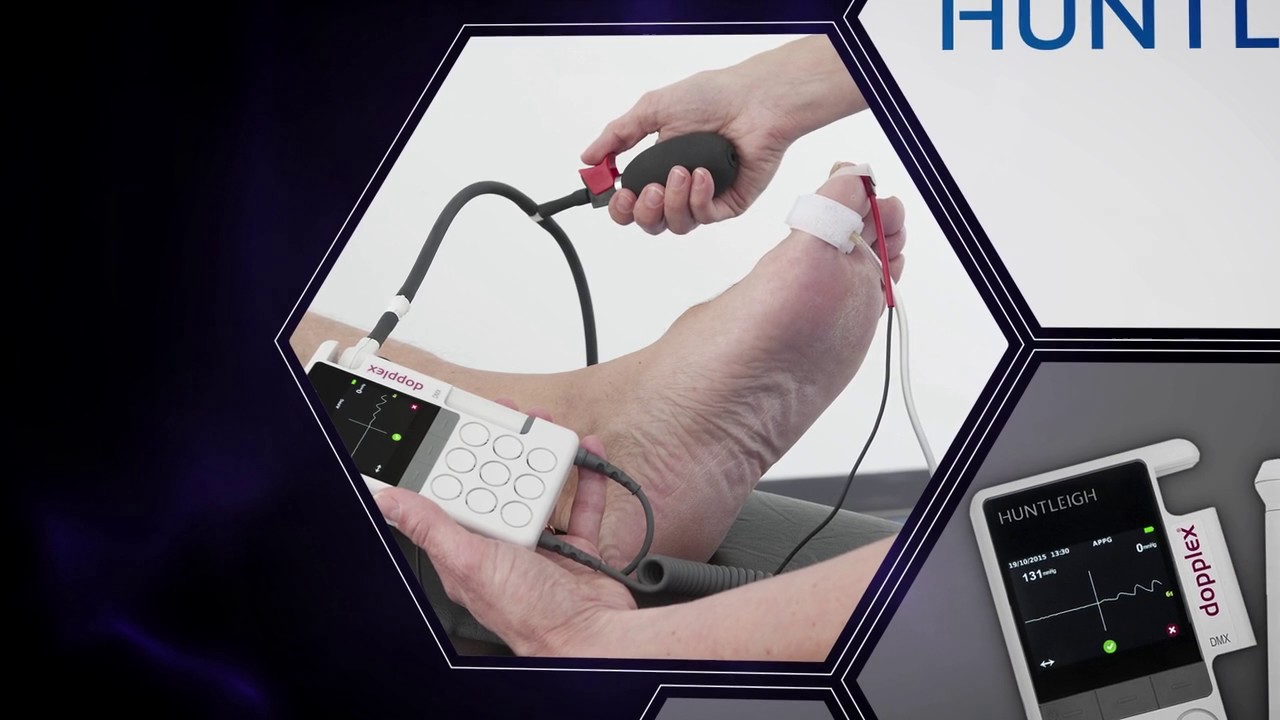 Diagnostics Innovation Award 2015 by Huntleigh Healthcare