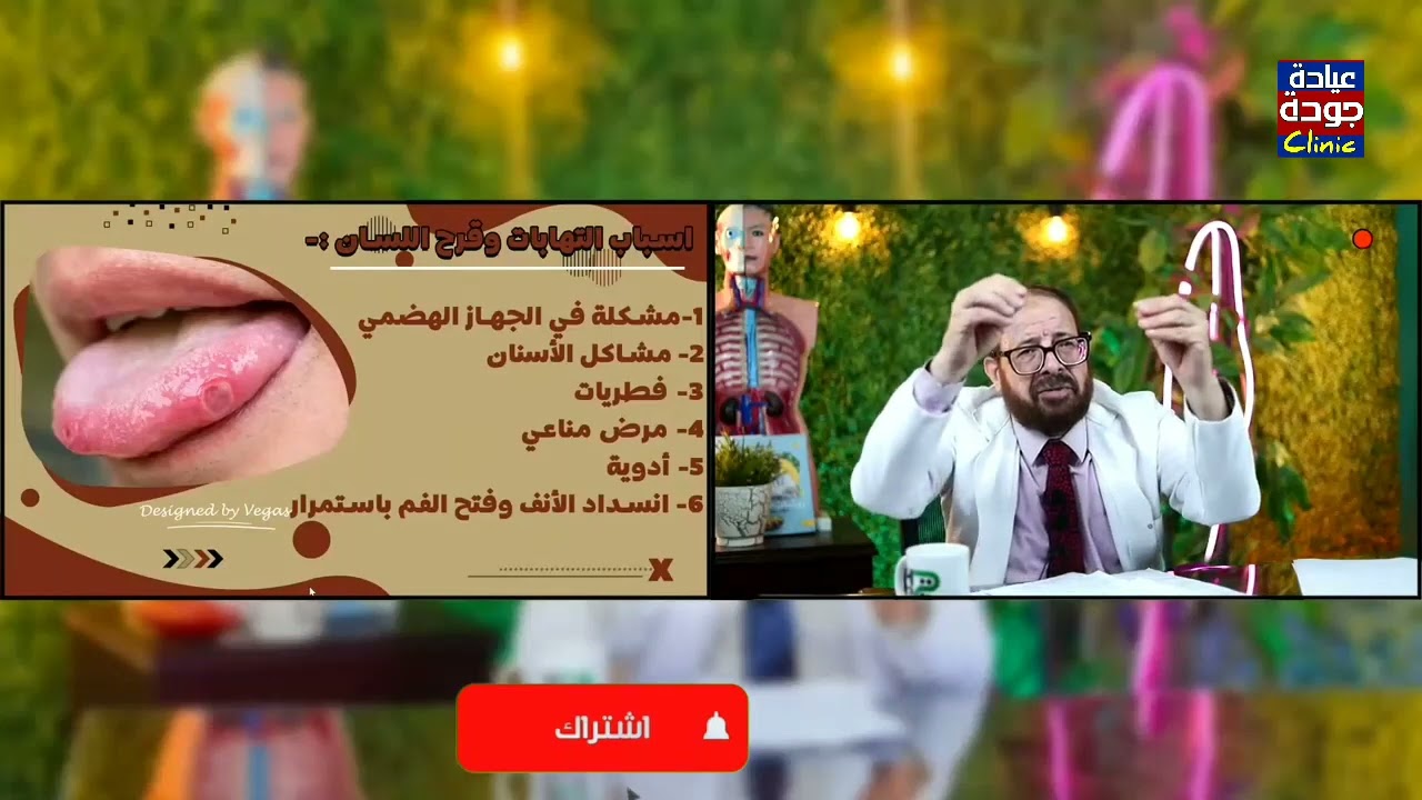 التهابات وقرح اللسان والفم | دكتور جودة محمد عواد | دكتور جودة محمد عواد