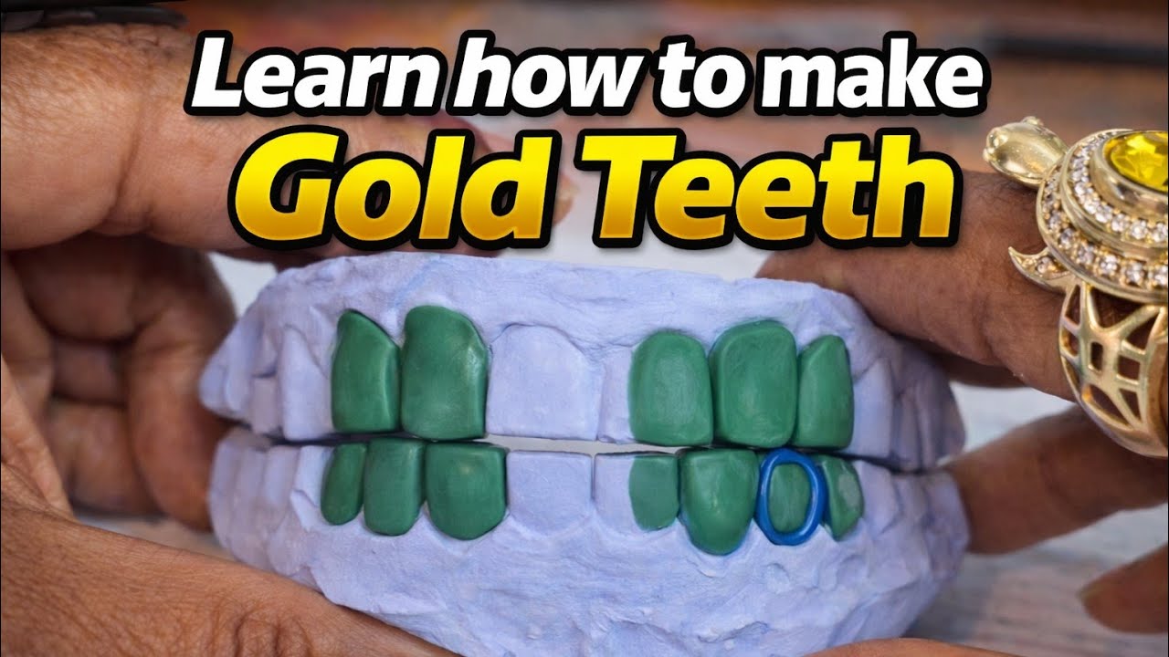 We are doing 3 grillz and casting 5 this week! Lost wax casting process! #grillz #crystals 