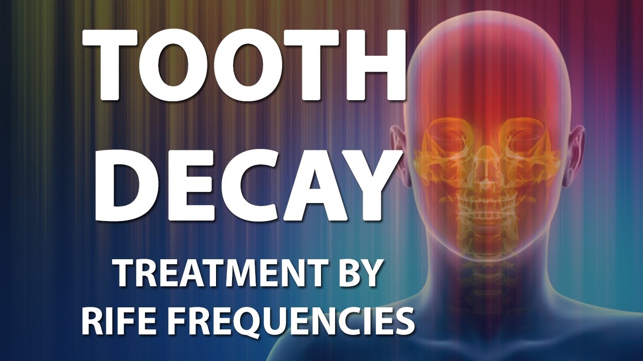 Tooth Decay - RIFE Frequencies Treatment - Energy & Quantum Medicine with Bioresonance