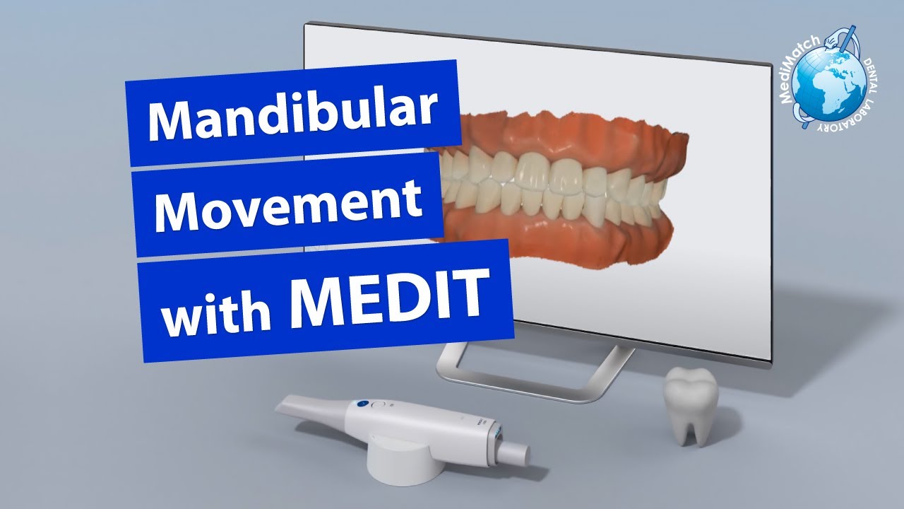 Mandibular Movement with Medit