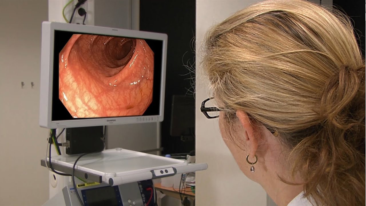 Vervolgtraject Bevolkingsonderzoek Darmkanker