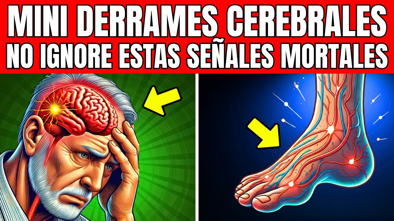 8 SIGNOS de MINI DERRAME CEREBRAL en ADULTOS MAYORES