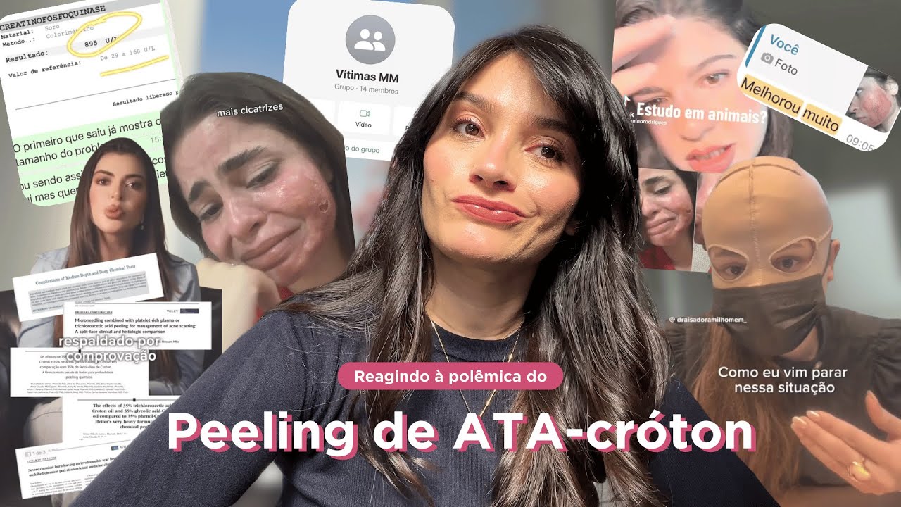 Reagindo à polêmica do Peeling de ATA-cróton | REACT | Thamires Nascimento ✨