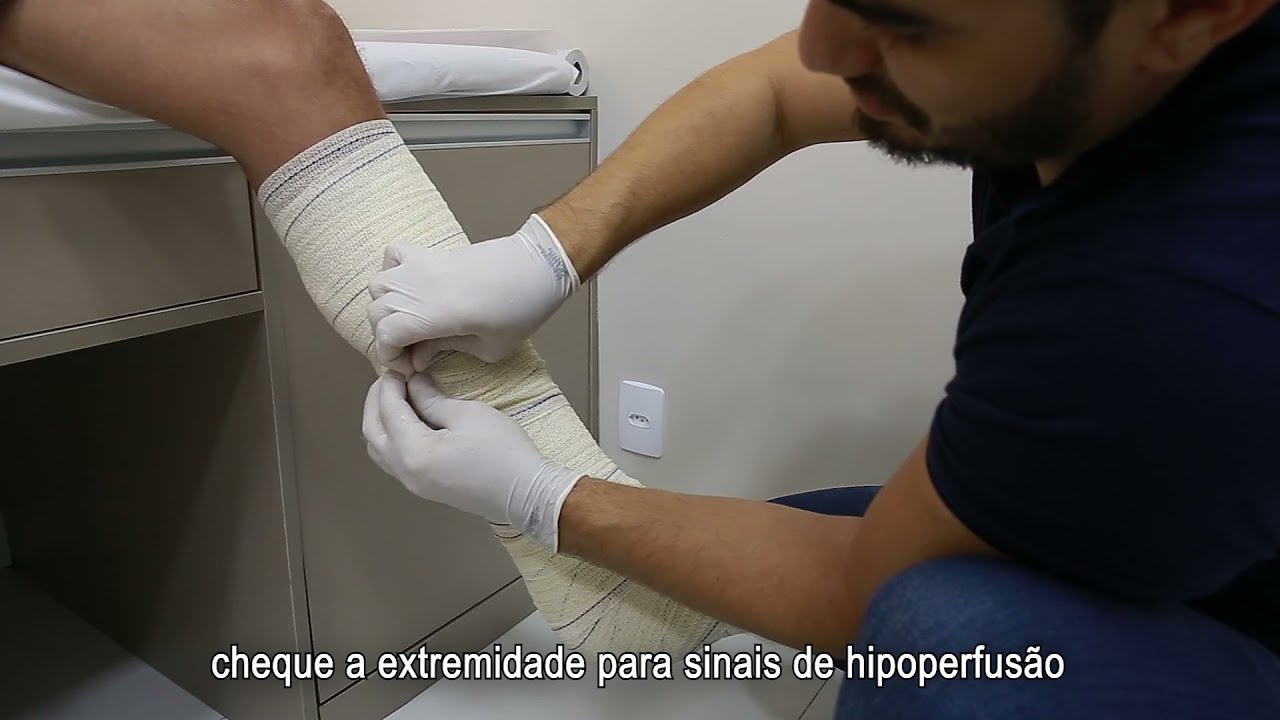 Dr. Nilo Lemos Neto - Confec&ccedil;&atilde;o de Imobiliza&ccedil;&atilde;o Tipo Bota