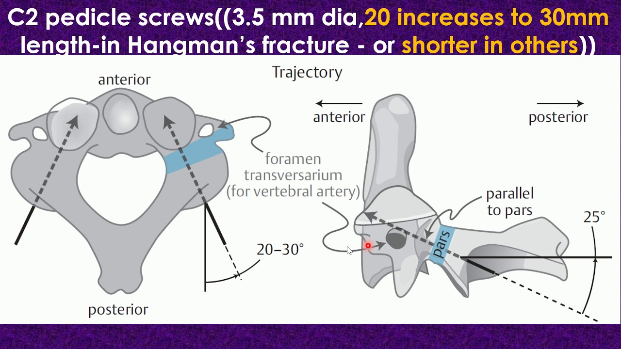 Atlantoaxial subluxation and dislocation
