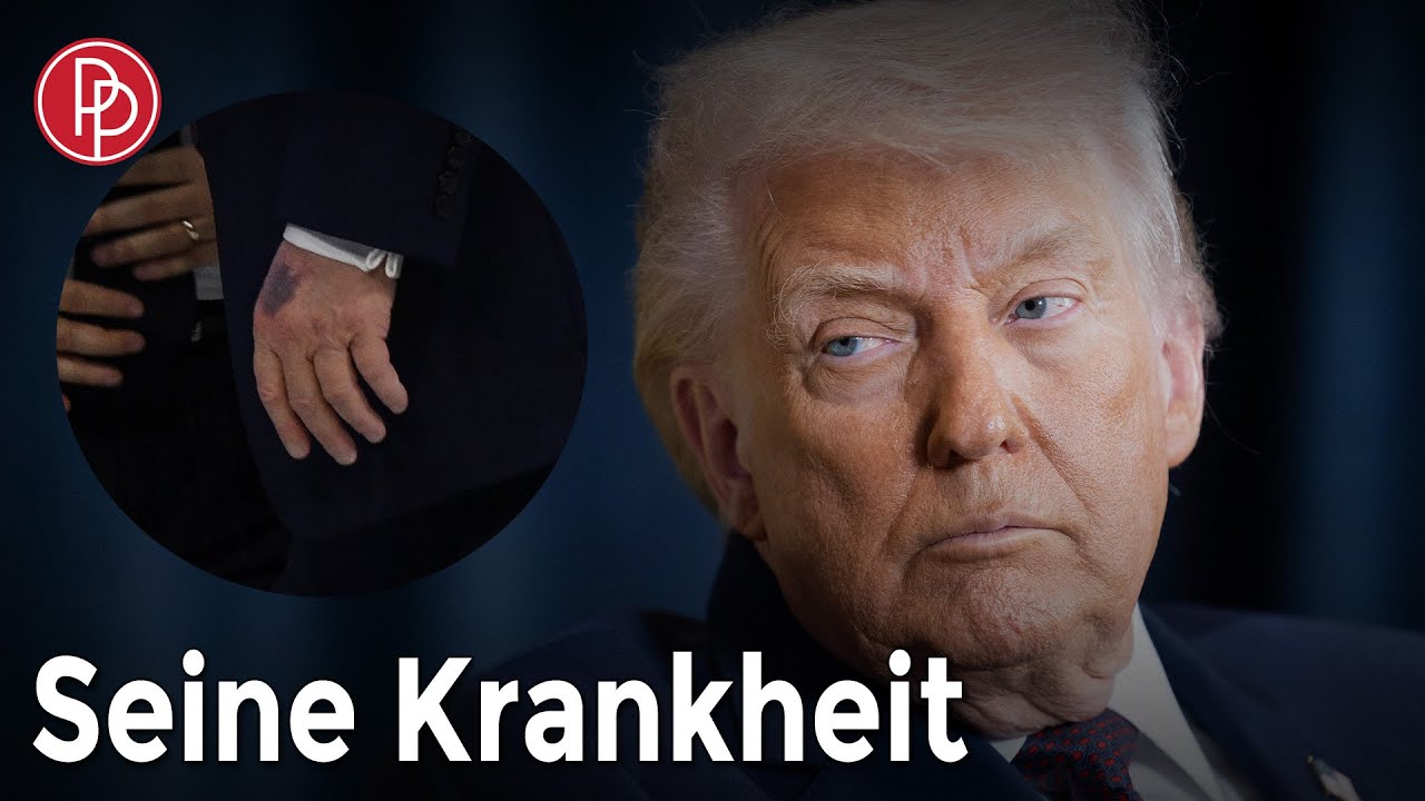 Donald Trump: An dieser Krankheit leidet er | PROMIPOOL