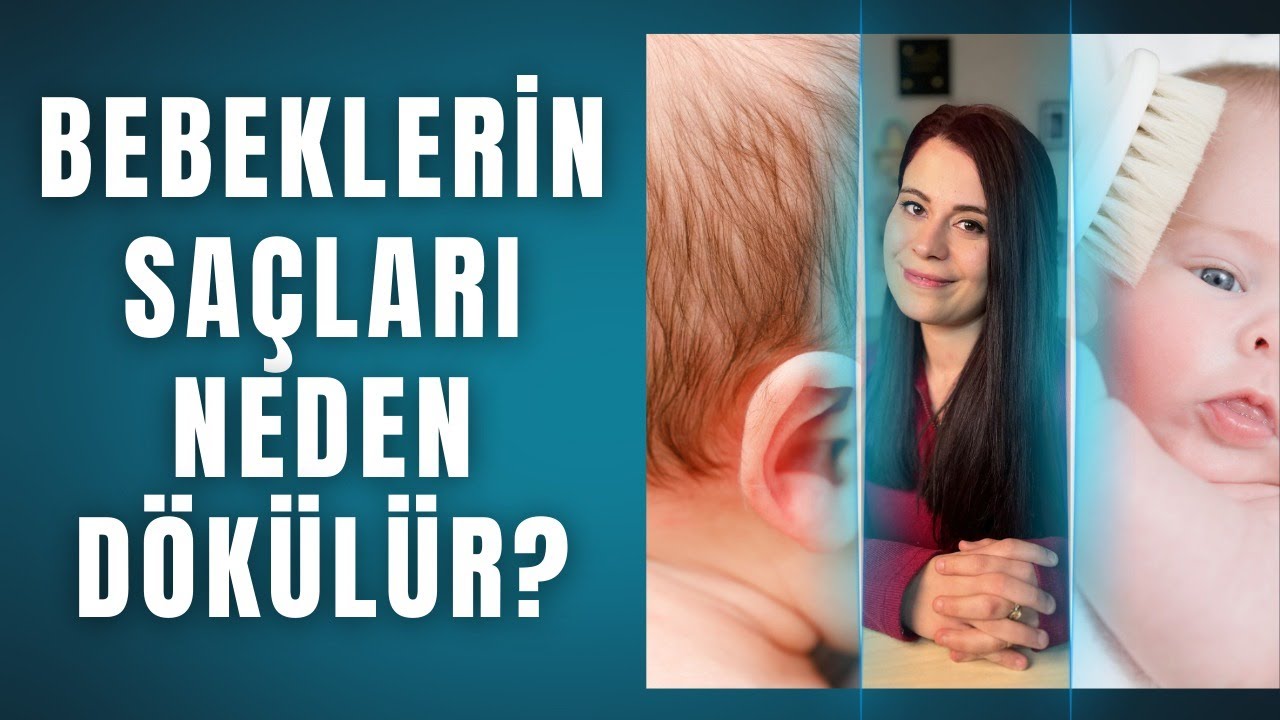 Bebeklerde Konak ve Saç Dökülmesi