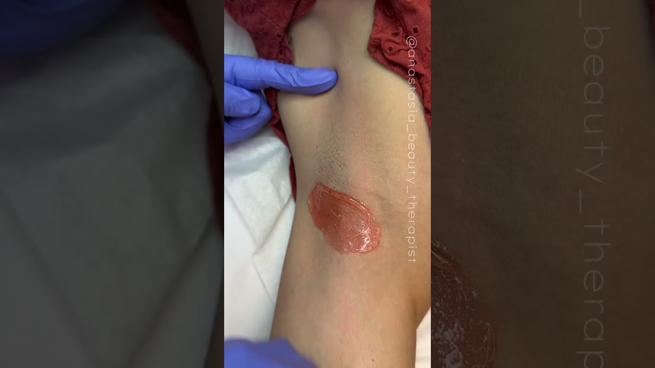 Waxing extra short hair in the underarm are with hard wax coral hard wax from Starpil esthetician 