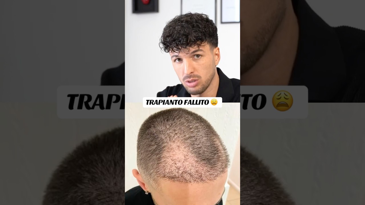 TRAPIANTO FALLITO
