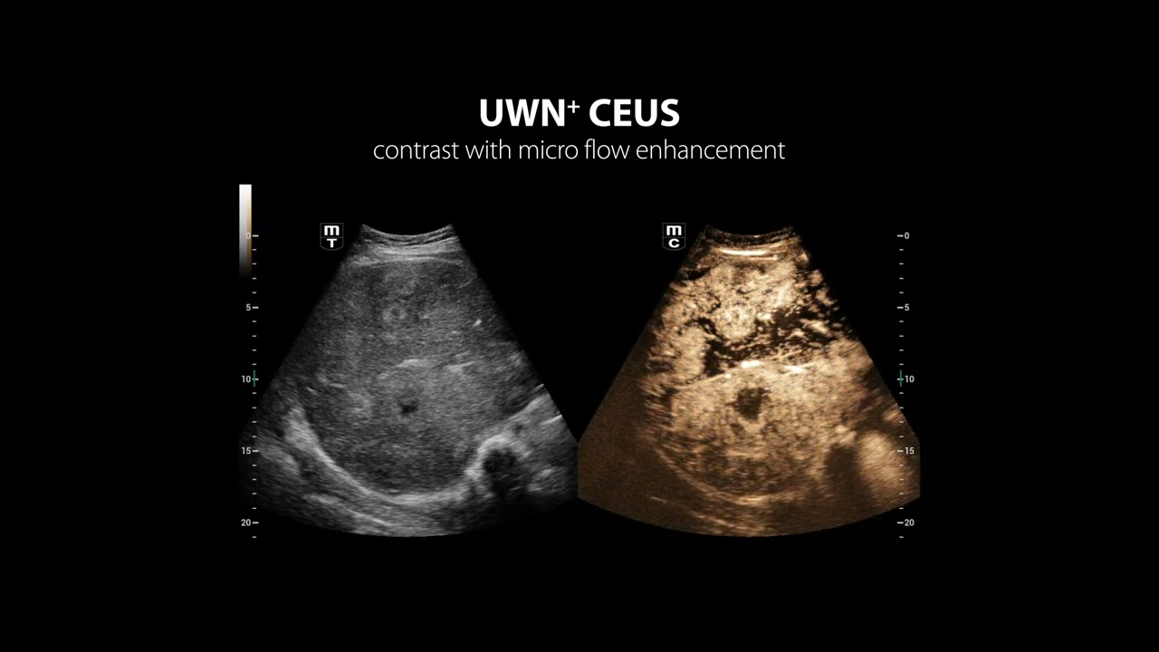 Resona I9 ultrasound system, innovation in every facet