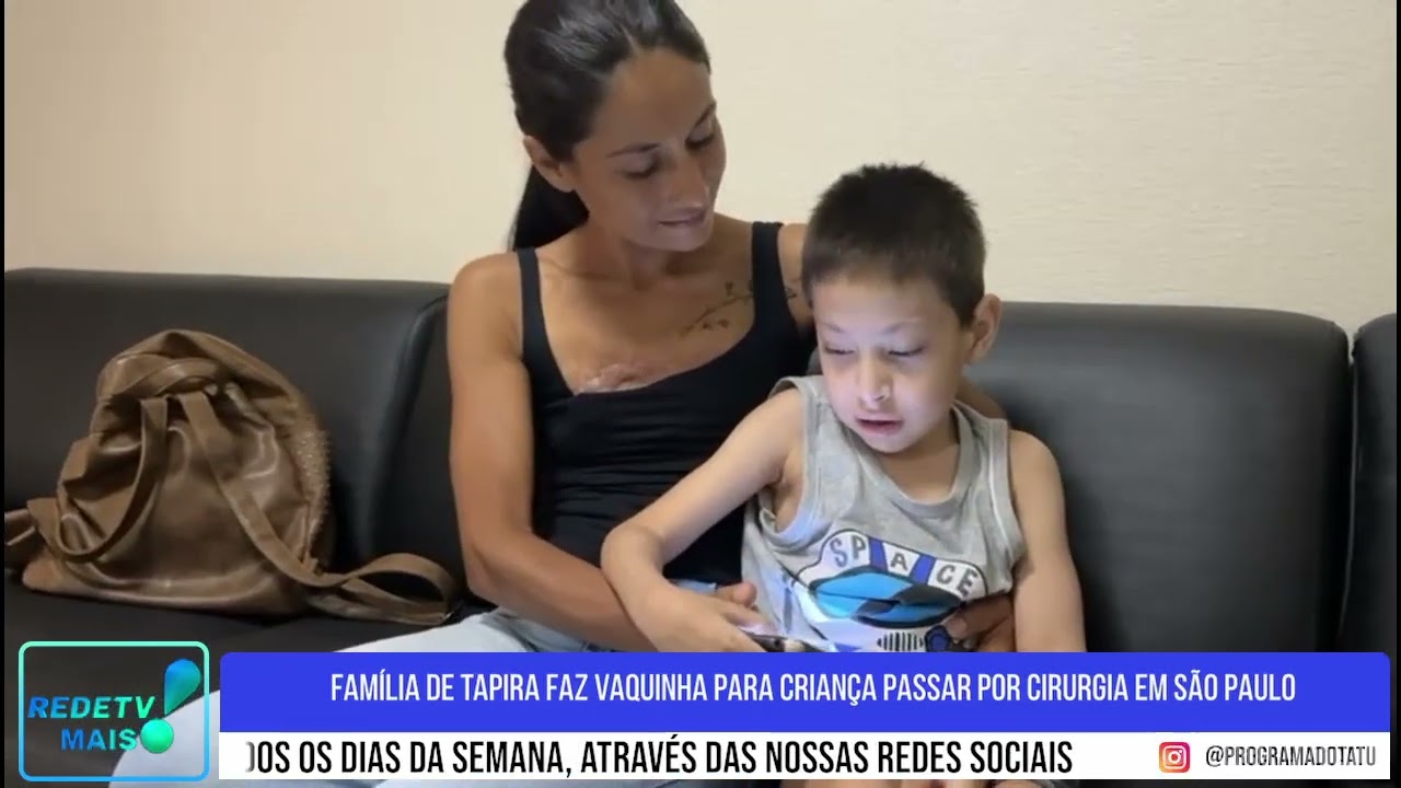 Família de Tapira faz vaquinha para criança passar por cirurgia em São Paulo