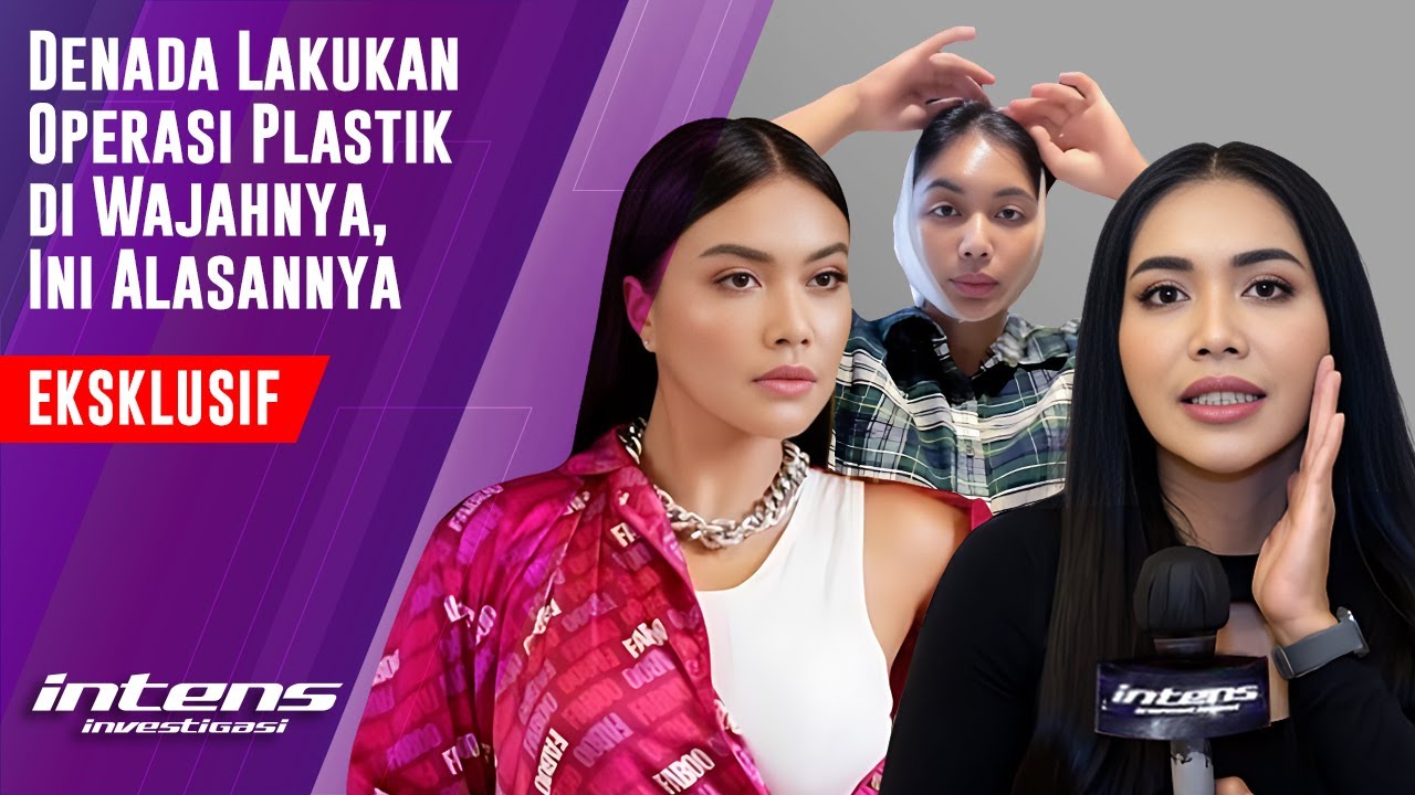 Ini Alasan Denada Lakukan Operasi Plastik di Wajahnya