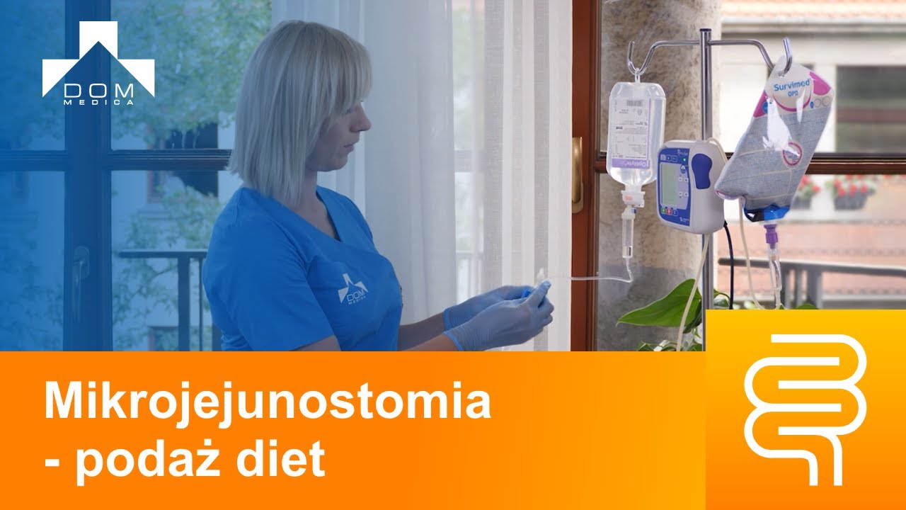 Mikrojejunostomia  - podaż diety w żyweniu dojelitowym