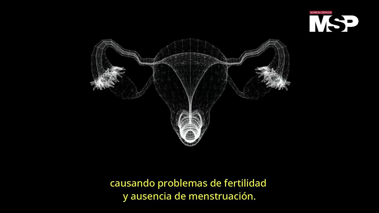 &iquest;Qu&eacute; es el S&iacute;ndrome de Turner y c&oacute;mo afecta a las mujeres?