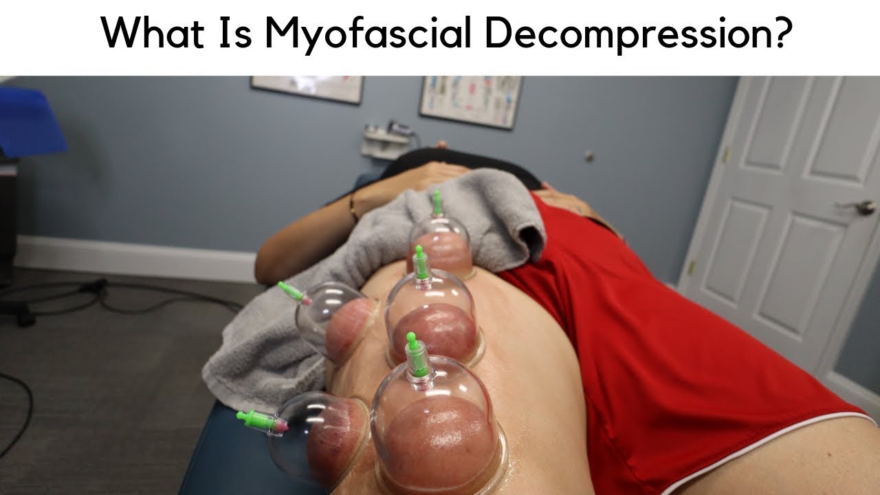 What Is Myofascial Decompression?  Chiropractor In Burke, VA