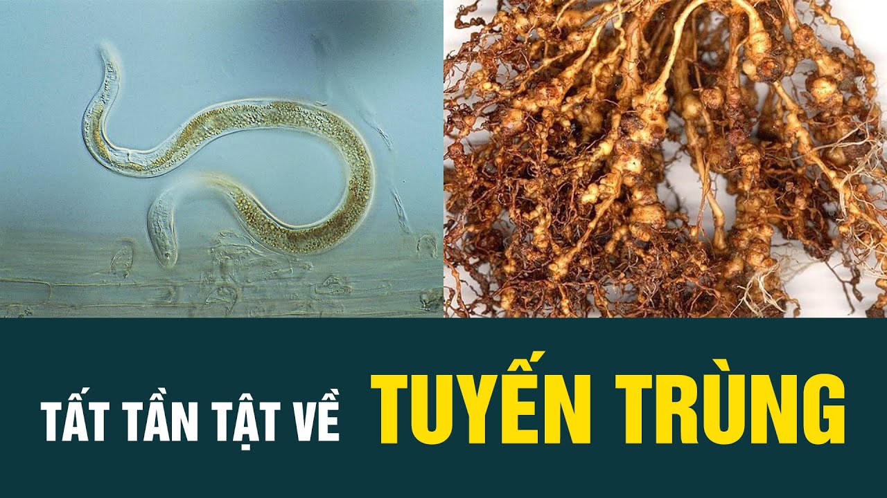 TẤT TẦN TẬT VỀ TUYẾN TRÙNG HẠI RỄ