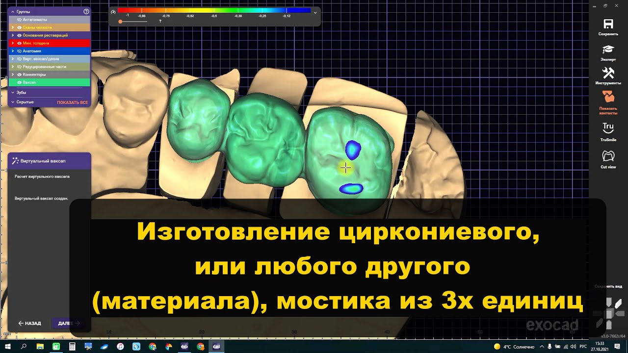 Циркониевые коронки в exocad Изготовление мостика Моделирование зубов Видео с индивидуального курса.