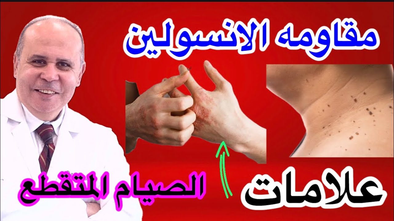 مقاومه الانسولين ..بدايه مرض السكري..علامات خطيره في جسمك ...الصيام المتقطع