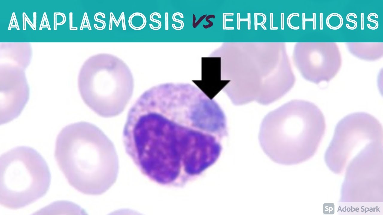 Anaplasmosis vs Ehrlichiosis (Anaplasma phagocytophilum vs Ehrlichia chaffeensis & ewingii)