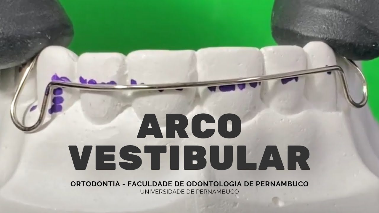 Arco Vestibular