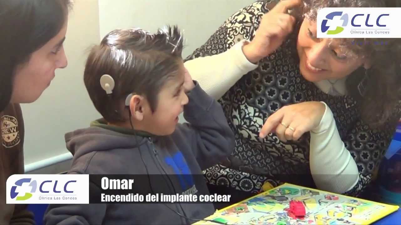 Programa de implante y encendido coclear [Clínica Las Condes]