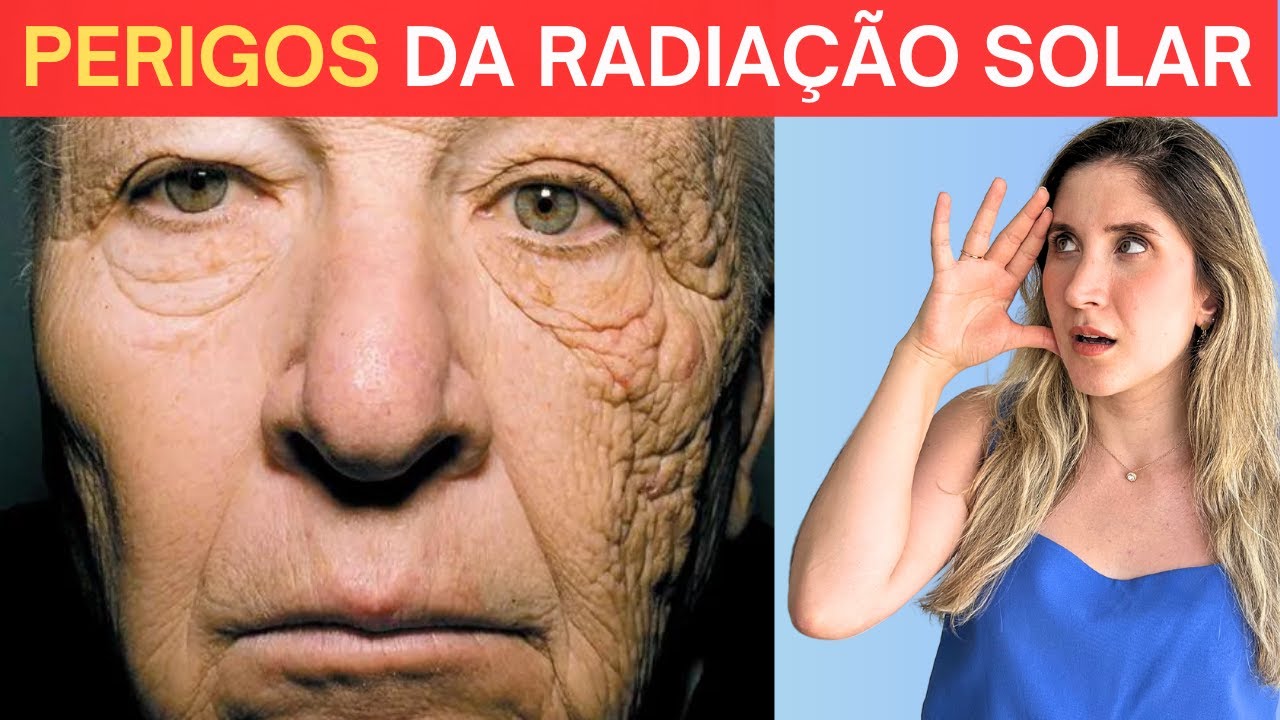 Proteção Solar- Guia Definitivo p/ se Proteger do Sol- [Dermato Explica]