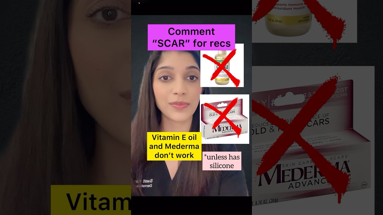 Use THIS for Scar Reduction (not Vit E Oil)