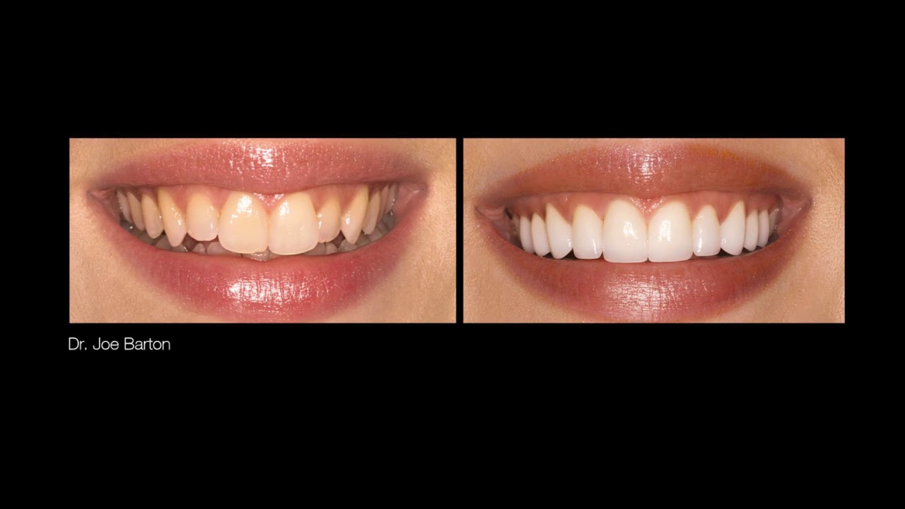 MicroDental California