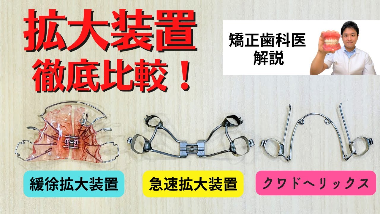 【矯正の拡大装置】急速拡大装置・緩徐拡大装置・クワドヘリックス|矯正歯科医が解説