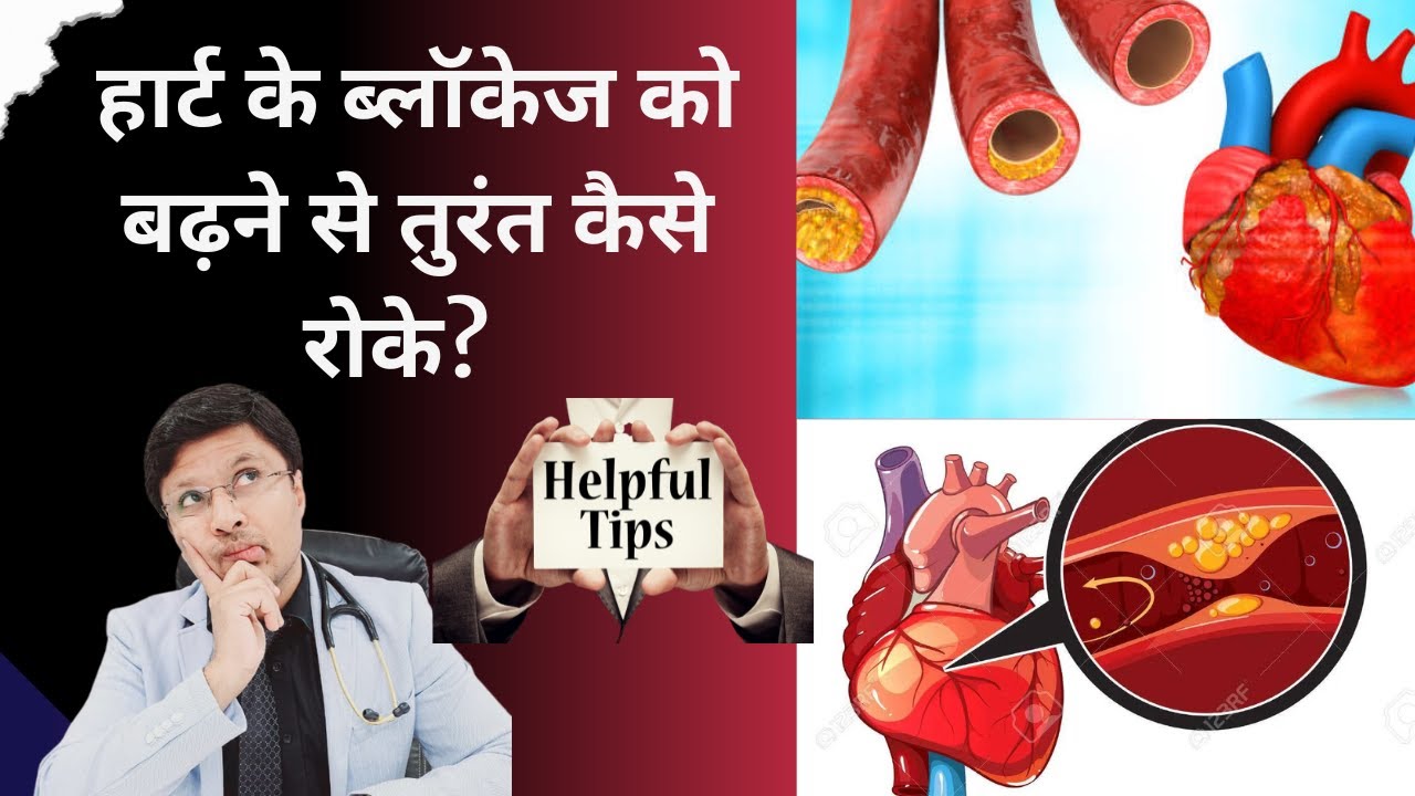 Prevent Heart Attack Tips:-How to stop blockages from Increasing