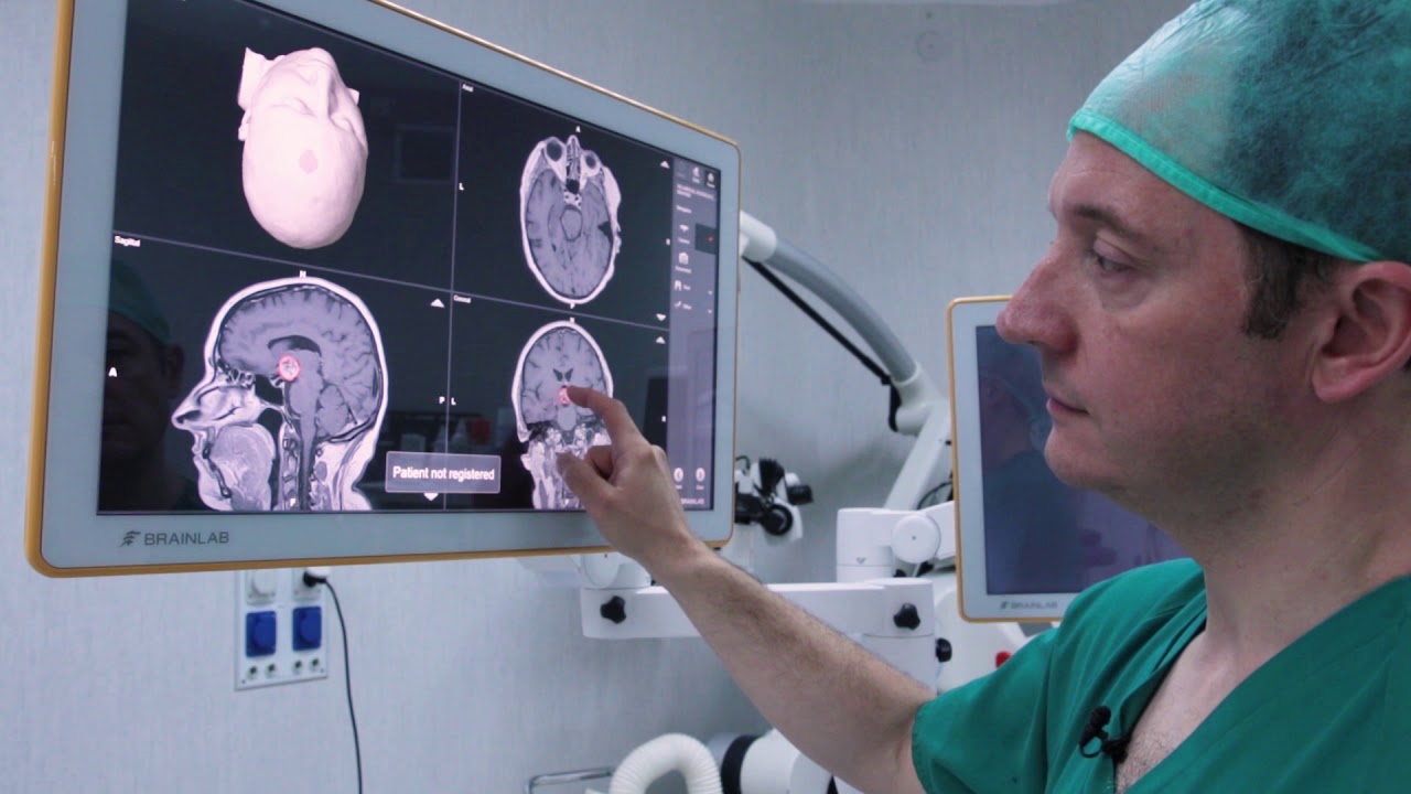 &iquest;Qu&eacute; es un Neuronavegador o GPS del cerebro?