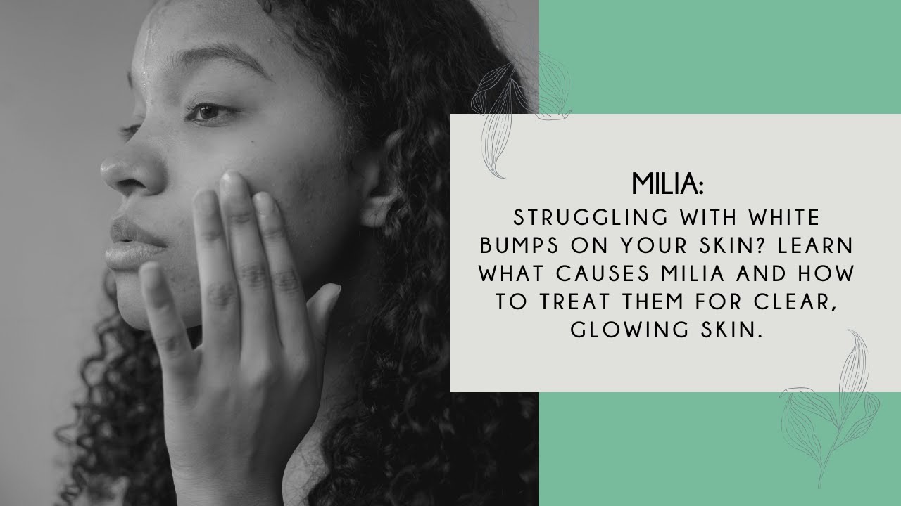What is Milia?