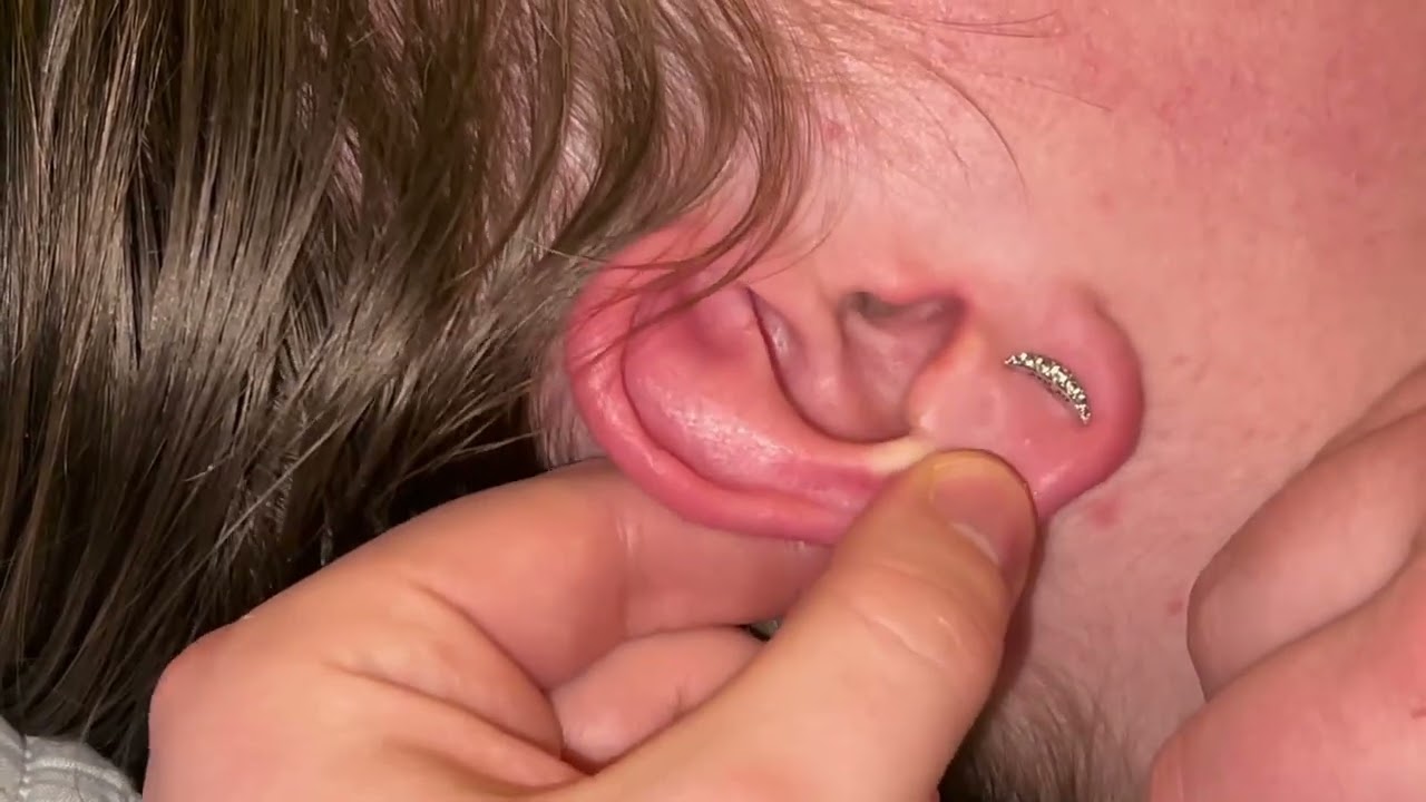 Ear Cleaning With a Cotton Bud - ASMR