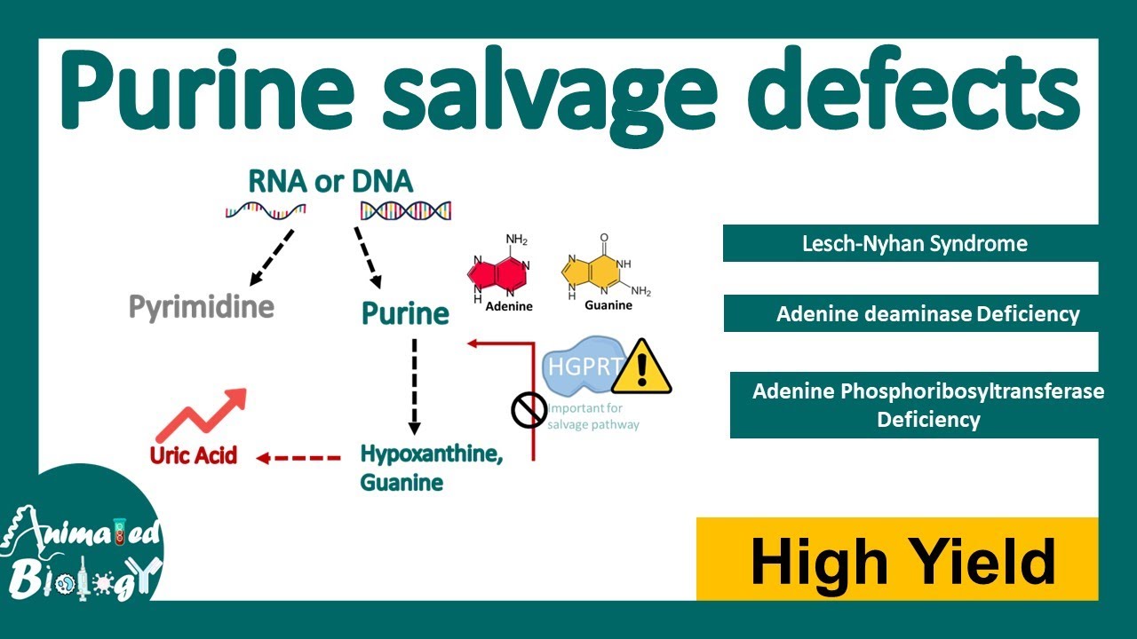 Purine Salvage Defects | Lesch-Nyhan Syndrome | Adenosine deaminase (ADA) deficiency