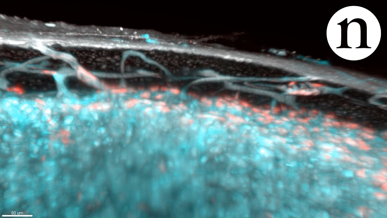 Transparent bones reveal hidden blood vessels