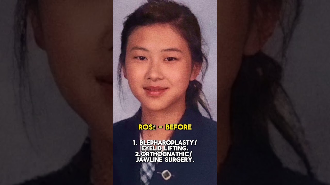 BLACKPINK MEMBERS PLASTIC SURGERIES! *NO HATE*  #blackpink #plasticsurgery