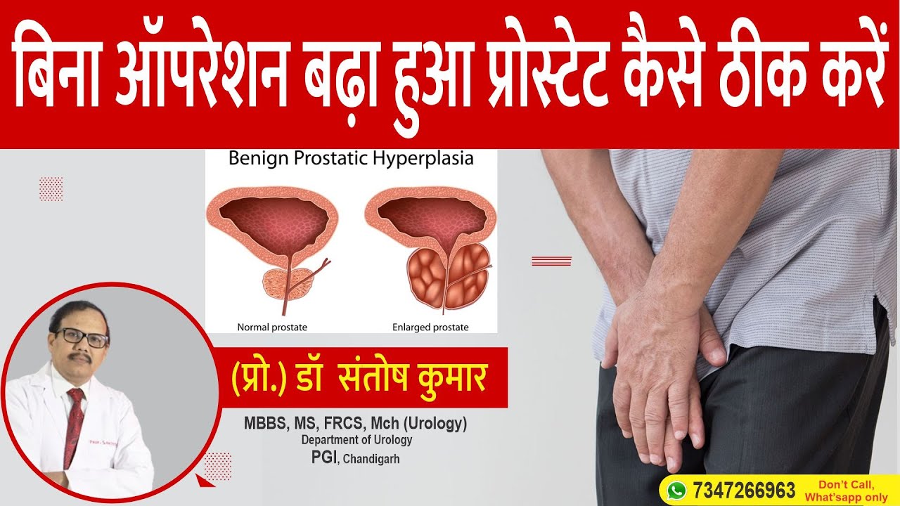 प्रोस्टेट का साइज कैसे कम करें? How to Reduce Prostate Size Without Surgery