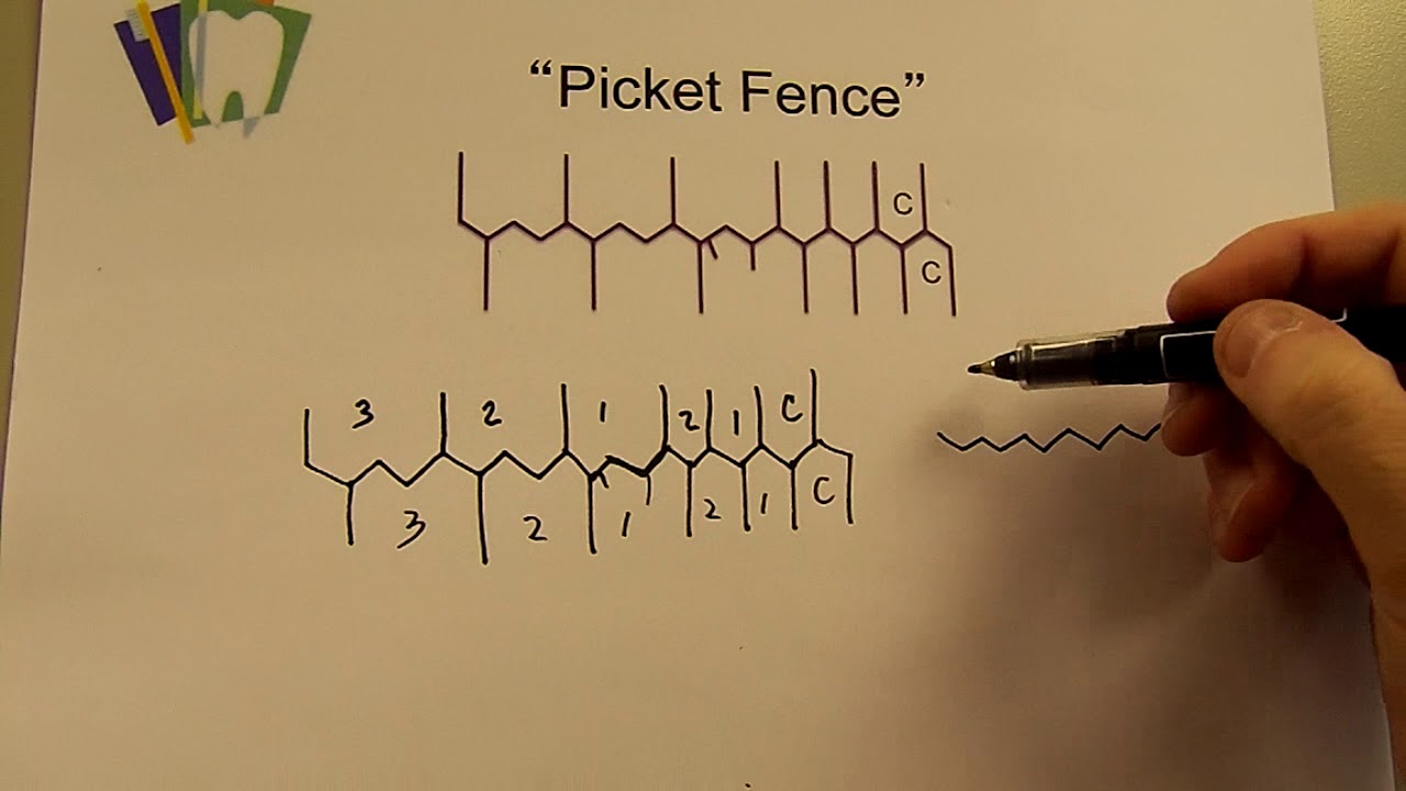 Drawing Picket Fence--Part One