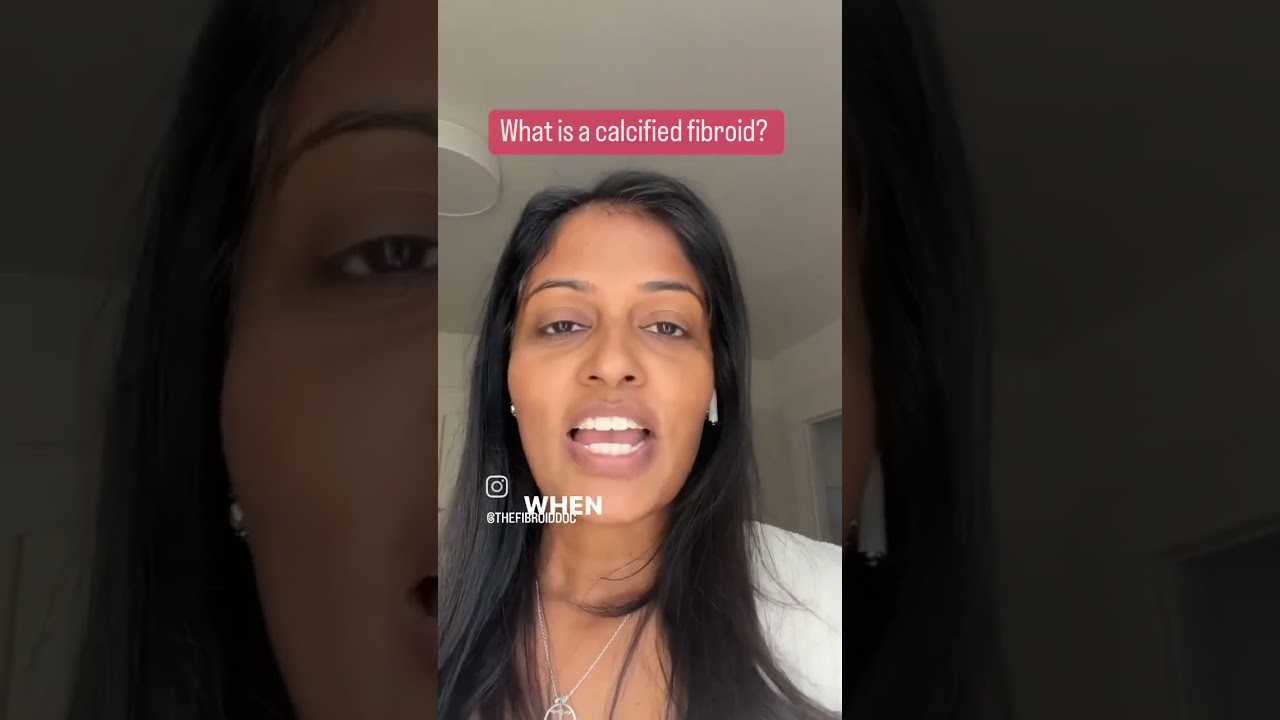 Did your doctor tell you have a #CalcifiedFibroid? #TheFibroidDoc #lamorindagyn #fibroids #DrCheruba