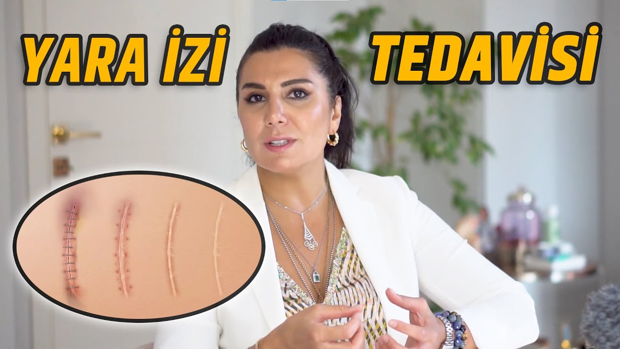KÖTÜ YARA İZİ NASIL DÜZELTİLİR?! | Op. Dr. Leyla Arvas