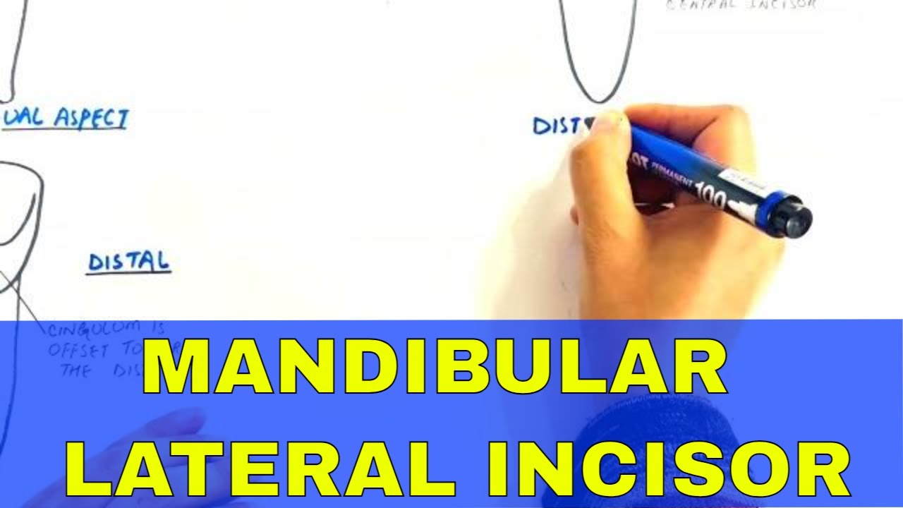 Anatomy of Mandibular Lateral Incisor - Tooth Morphology