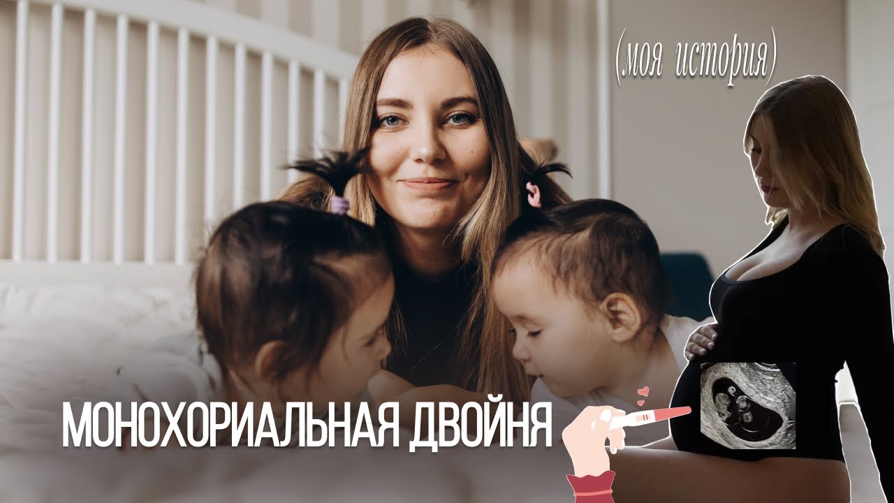 БЕРЕМЕННОСТЬ БЛИЗНЕЦАМИ // Монохориальная диамниотическая двойня // Моя история